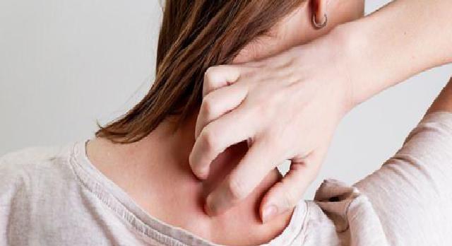 Alfa-Gal Sendromu: Kene Isırıklarıyla Gelen Alerjik Reaksiyonlar Hakkında Bilgilendirici Rehber