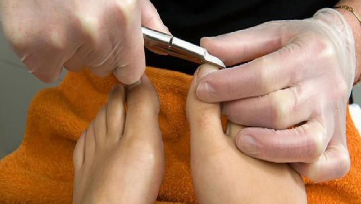 Ayak bakımı deyip geçmeyin, enfeksiyon riski hat safhada! Sinyali buymuş