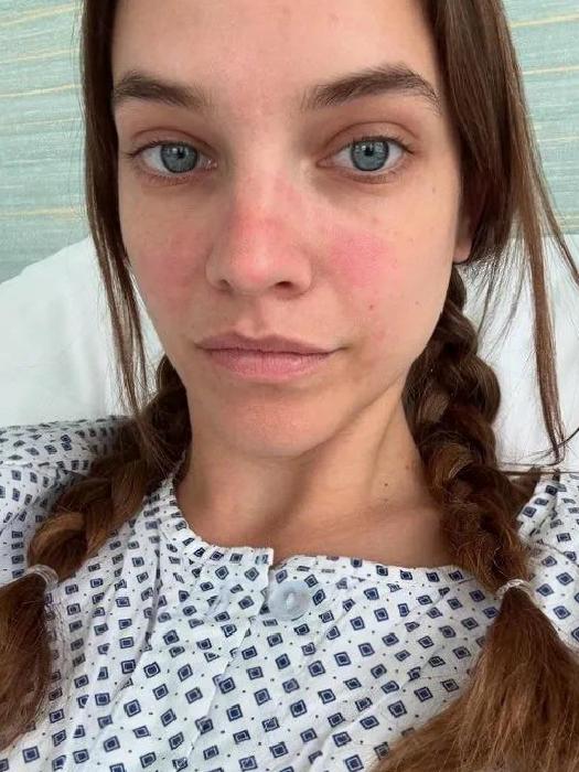 Barbara Palvin'den sevenlerini üzen haber: Hastalığını açıkladı!
