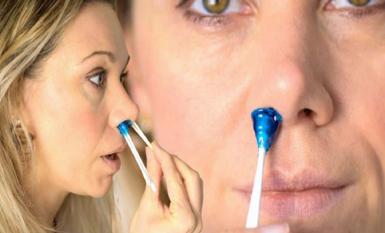 Burun Kılı Ağdası ve Sağlık Riski: Estetik İçin Girişilen Uygulamanın Sonuçları