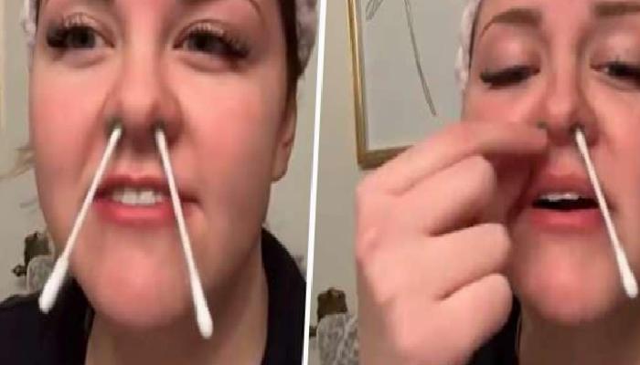 Burun Kılı Ağdası ve Sağlık Riski: Estetik İçin Girişilen Uygulamanın Sonuçları