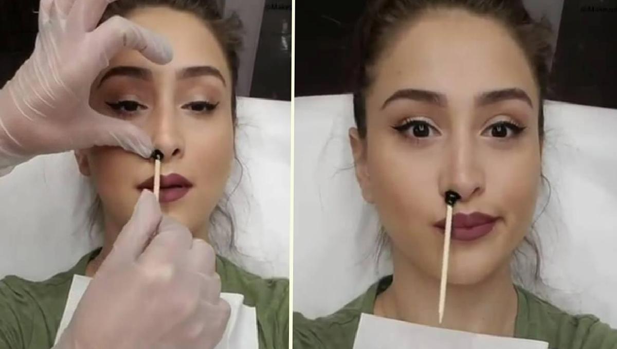 Burun Kılı Ağdası ve Sağlık Riski: Estetik İçin Girişilen Uygulamanın Sonuçları