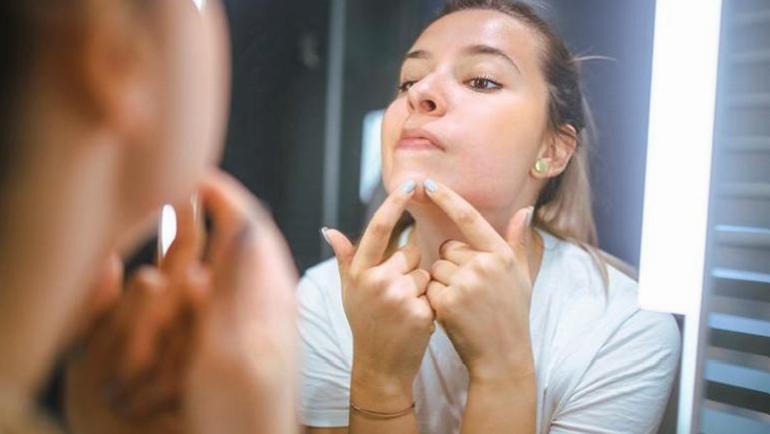 Çenedeki siyah noktalar için muhteşem çare! Buharla temizle, salisilik asitle sıfırla