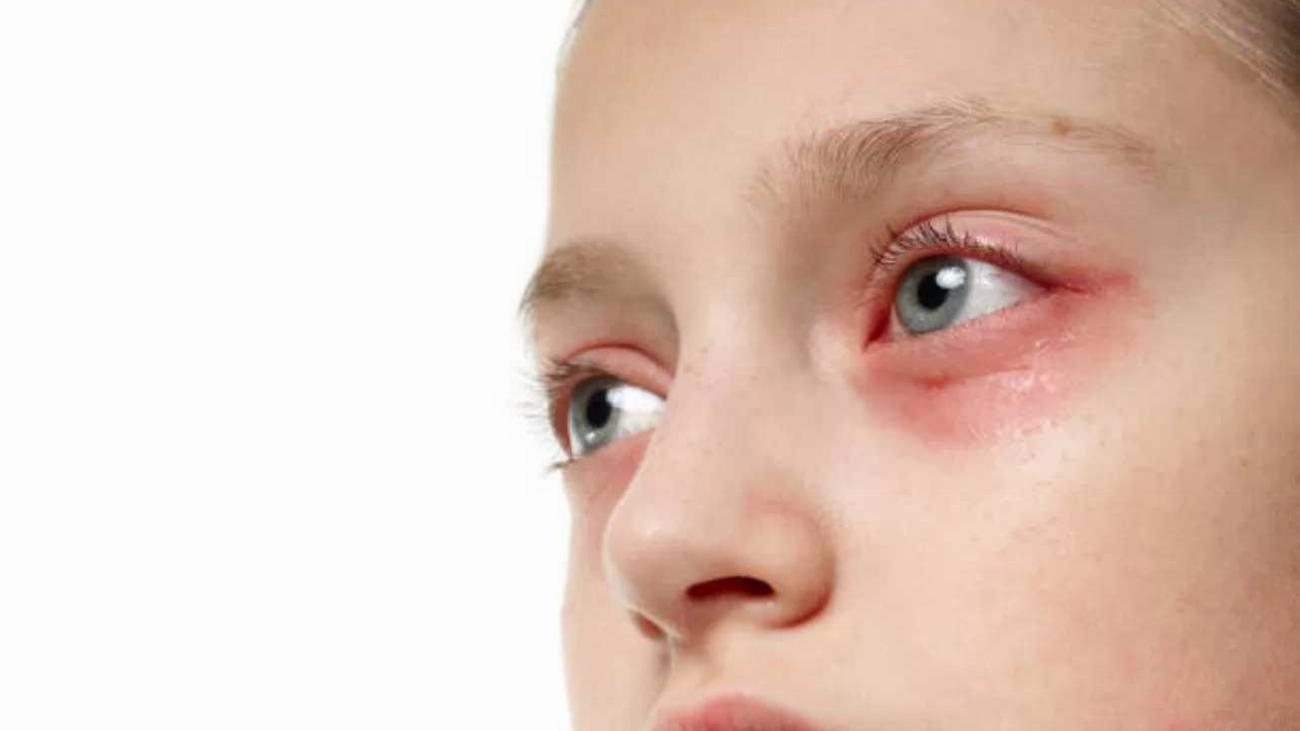 Havuz ve Denizde Çocuklar İçin Göz Sağlığını Koru: UV Koruması ve Gözlük Kullanımı