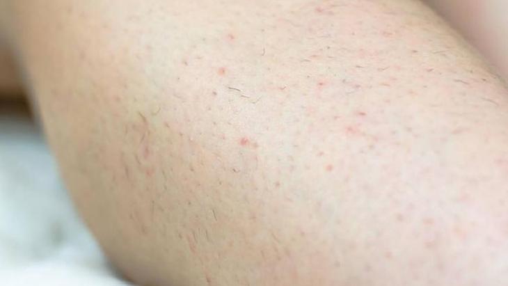 Doğru Tıraş Teknikleri ve İpuçları