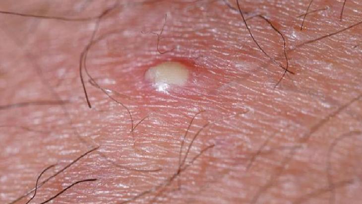 Doğru Tıraş Teknikleri ve İpuçları