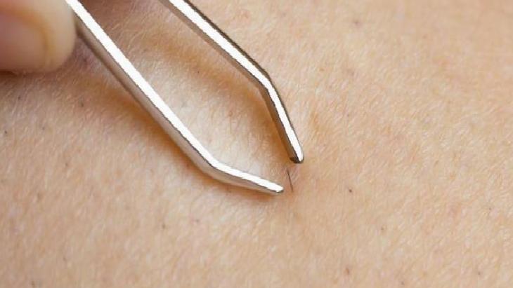 Her kılın ayrı derdi var! Doğru yöntemle batıklara veda edin, pürüzsüz cildin sırrı