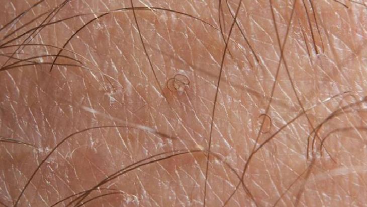 Her kılın ayrı derdi var! Doğru yöntemle batıklara veda edin, pürüzsüz cildin sırrı