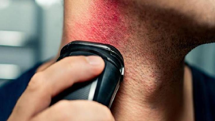 Her kılın ayrı derdi var! Doğru yöntemle batıklara veda edin, pürüzsüz cildin sırrı