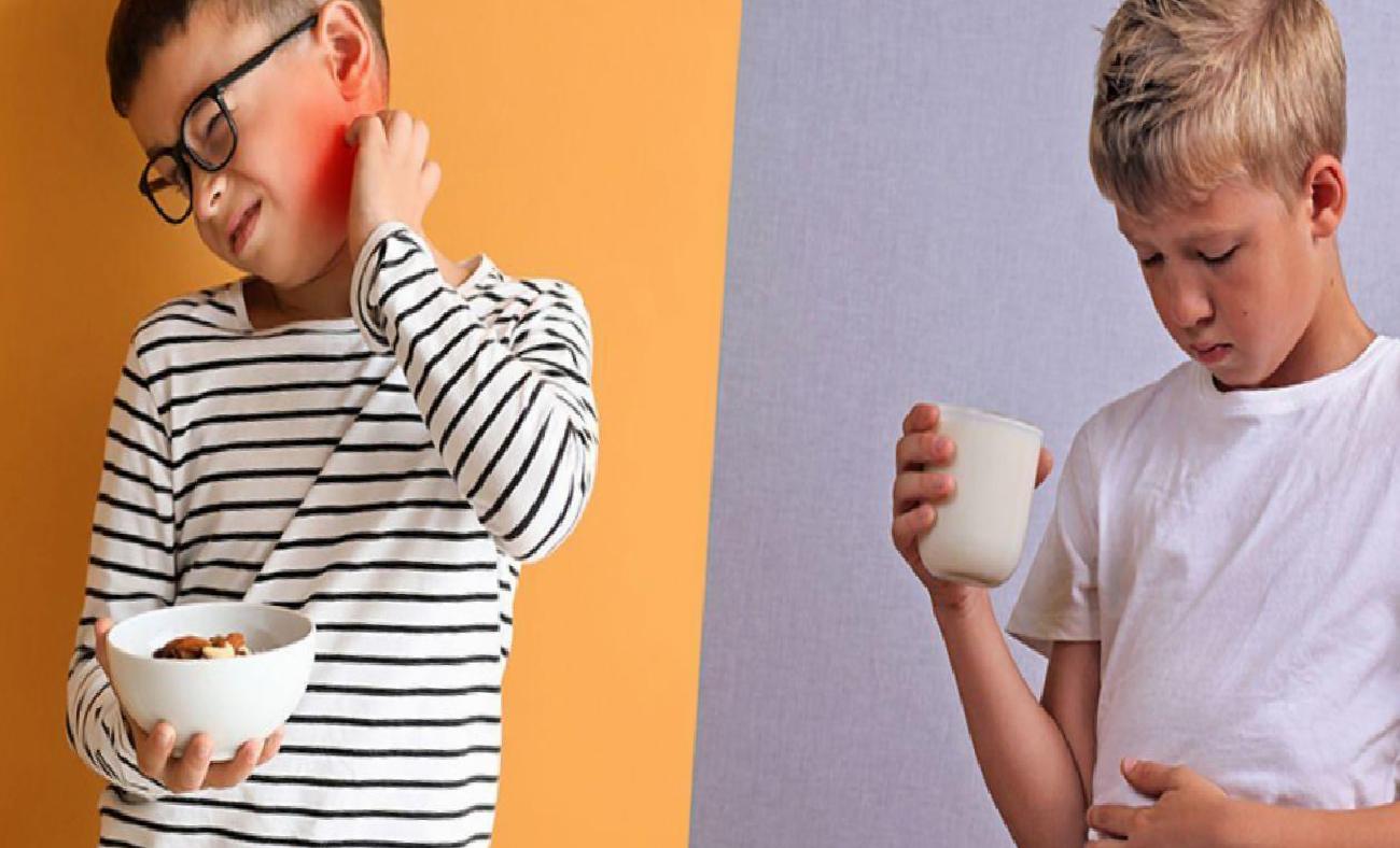 Besin alerjileri salgın gibi yayılıyor