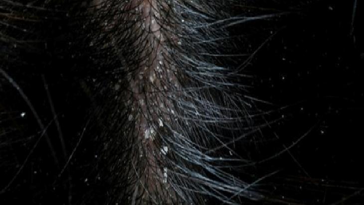 Saç Kurutma ve Yıkama Alışkanlıklarına Dikkat