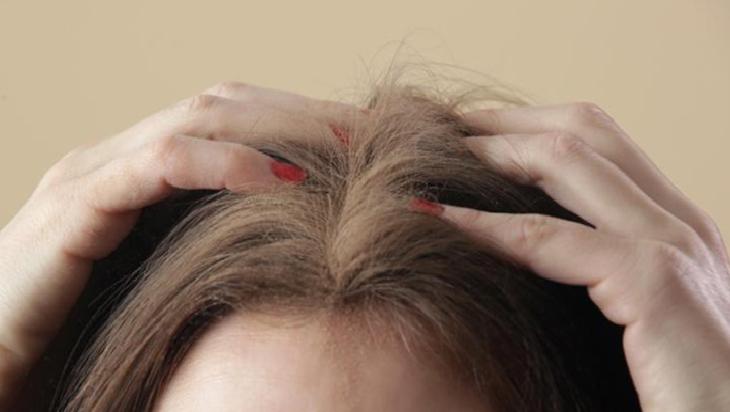 Yaz kepeğiye başa çıkmak çok kolay! Saçların kurtarıcısı: 3 yağlı çözüm yetiyor