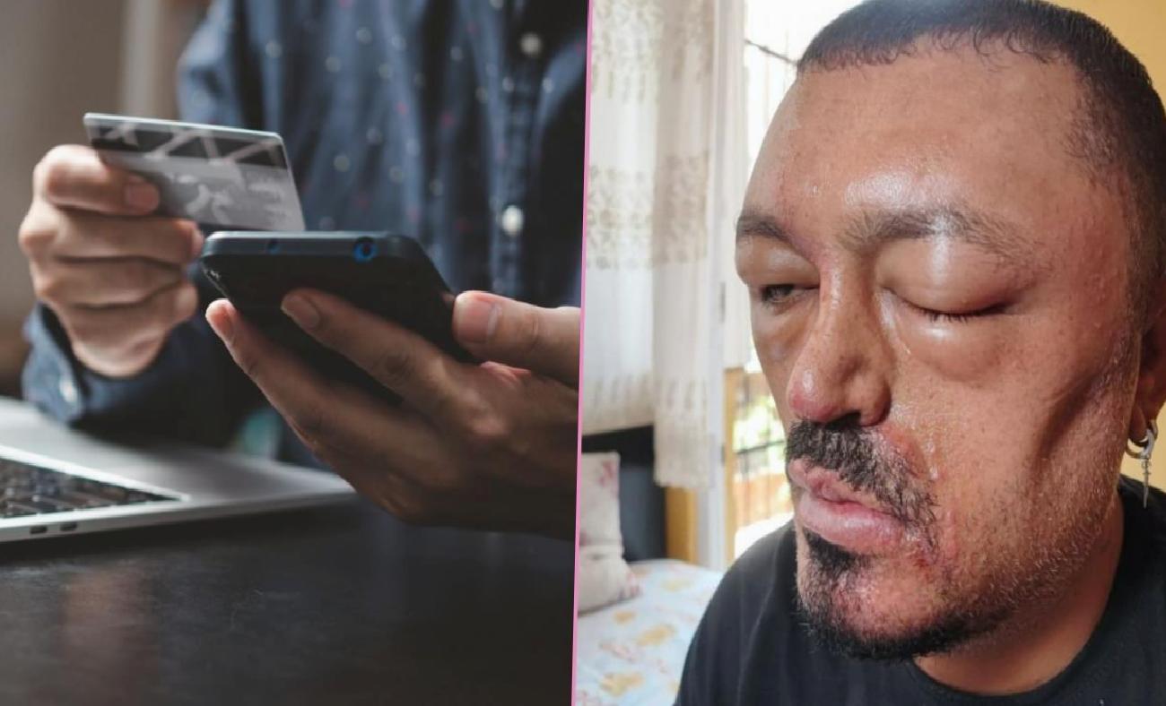 Güzellik Ürünlerinde Sahtecilik Tehlikesi: İnternetten Alınan Saç Siyahlaştırıcı Şampuan Faciası