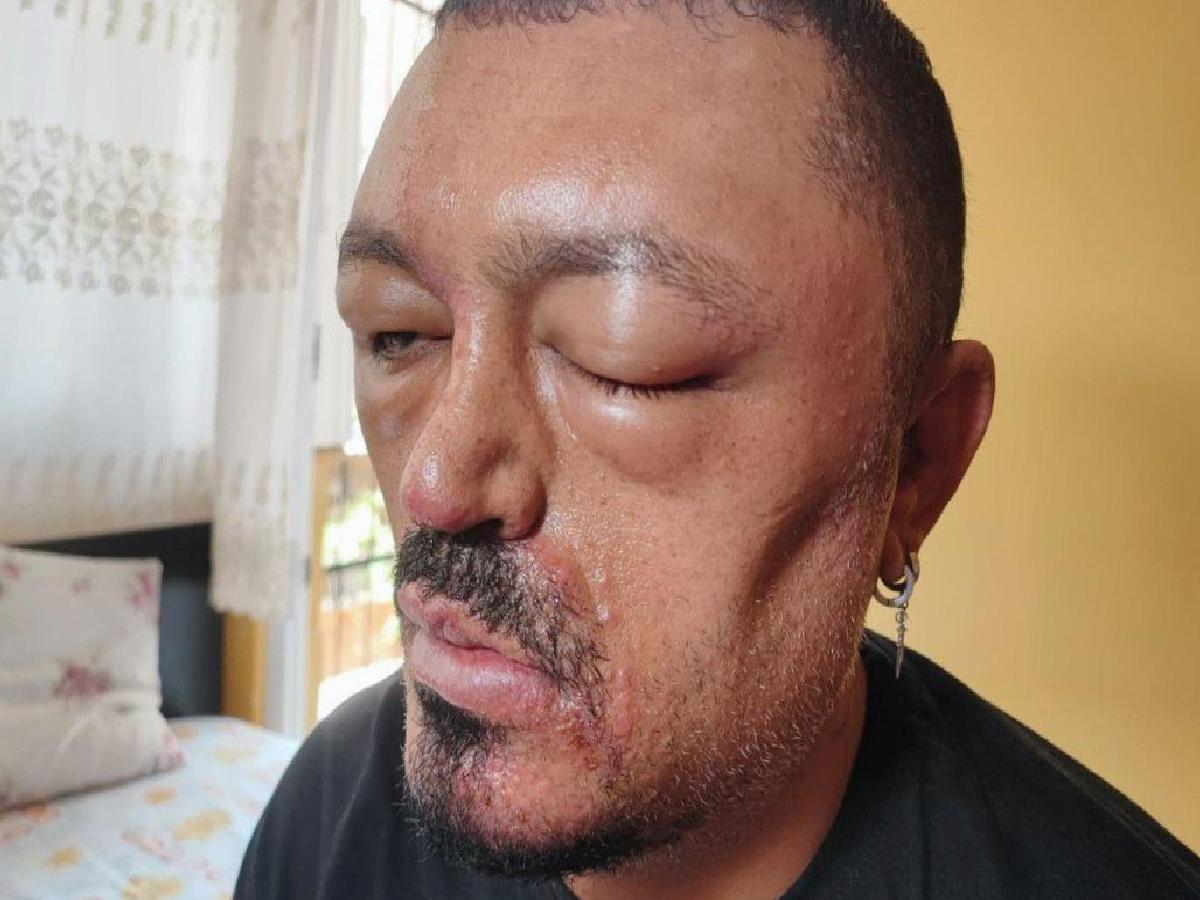 Güzellik Ürünlerinde Sahtecilik Tehlikesi: İnternetten Alınan Saç Siyahlaştırıcı Şampuan Faciası