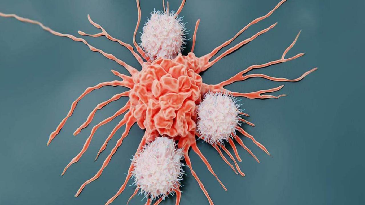 İngiltere'de Dil Kanseri: Grace Brand'in Yaşamını Değiştiren Bir Hikâye