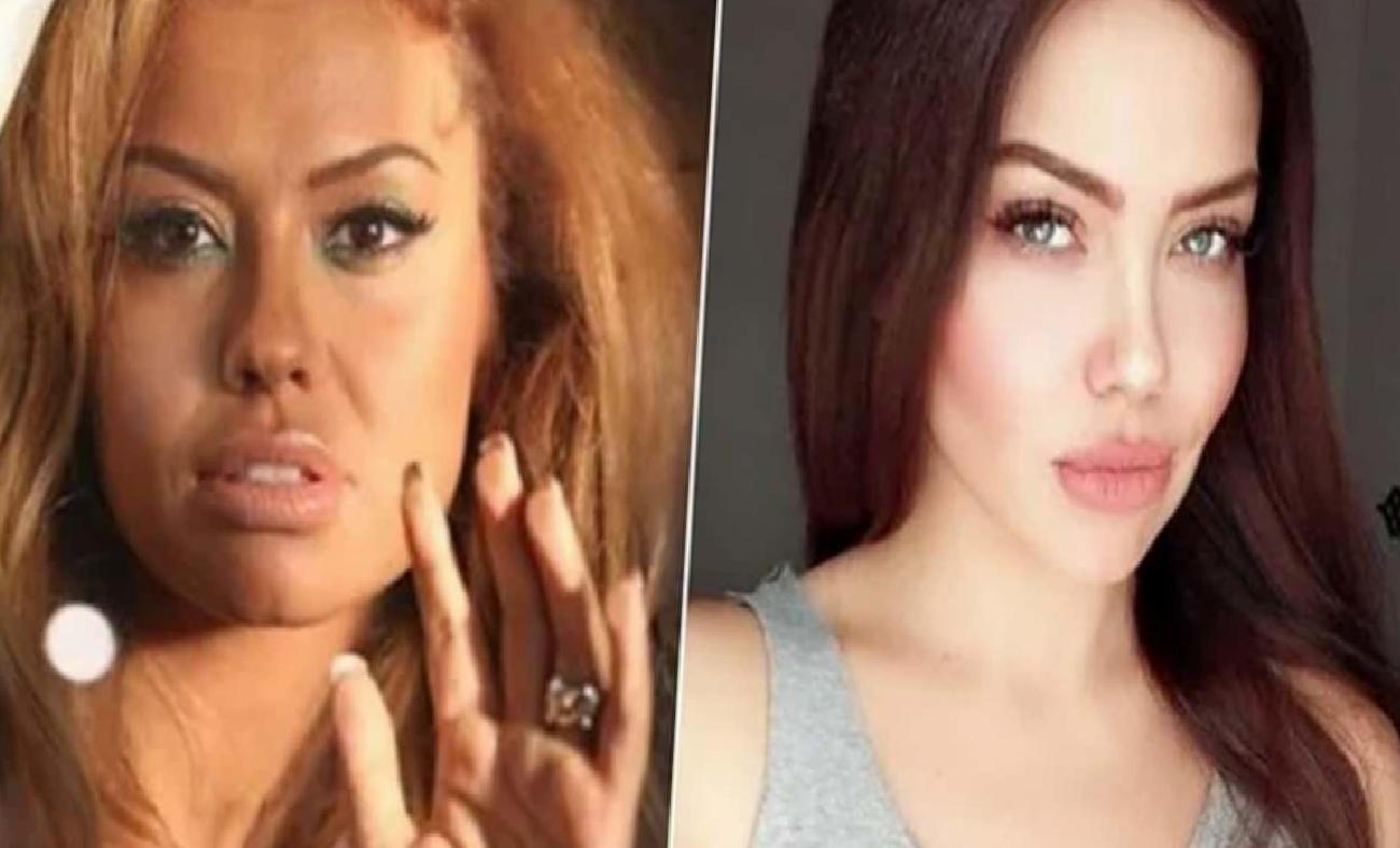 Lara: Beyinde Beliren Kitle Sonrası İyileşme Yolculuğu ve Yeniden Sahnelere Dönüş Müjdesi