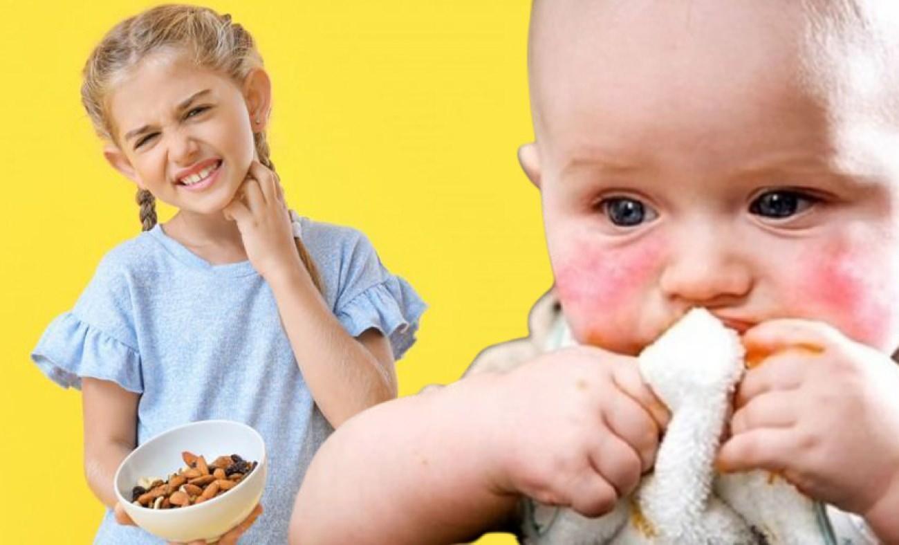 Okul Çağında Besin Alerjisi: Ailelerden Okula, Öğretmenlerden Mutfağa Kadar Alınması Gereken Tedbirler