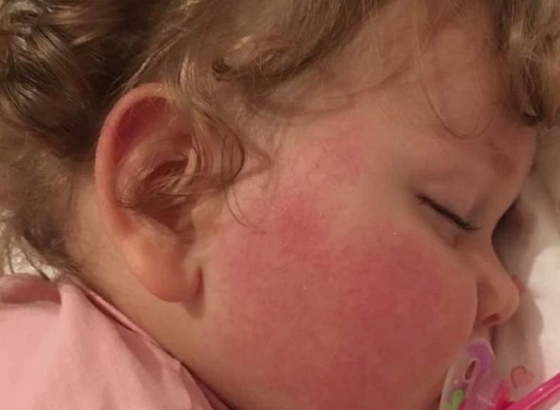 Okul Çağında Besin Alerjisi: Ailelerden Okula, Öğretmenlerden Mutfağa Kadar Alınması Gereken Tedbirler