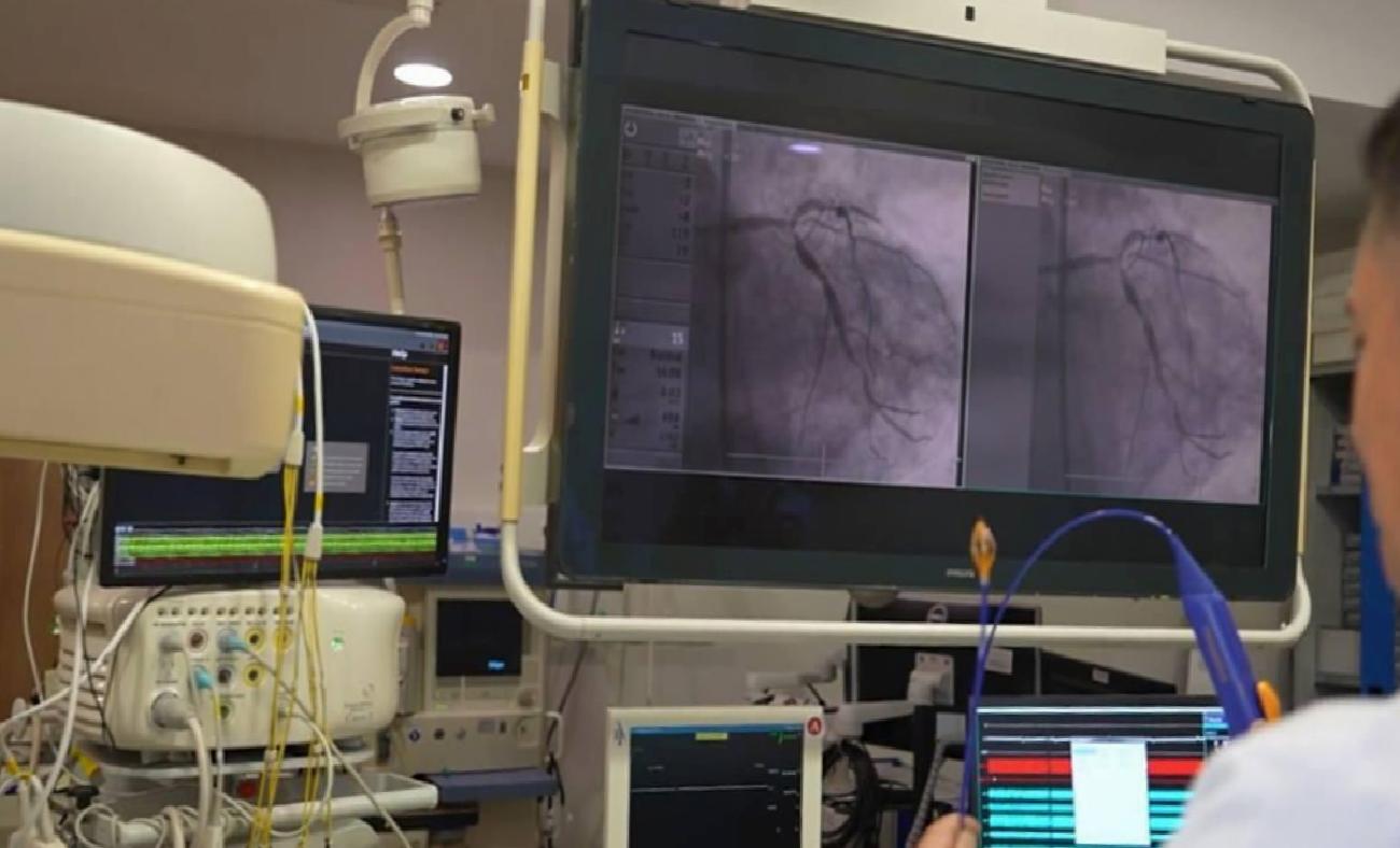 Pulsed Field Ablation (PFA): Ritim Bozukluklarında Yeni Nesil Güvenli Çözüm