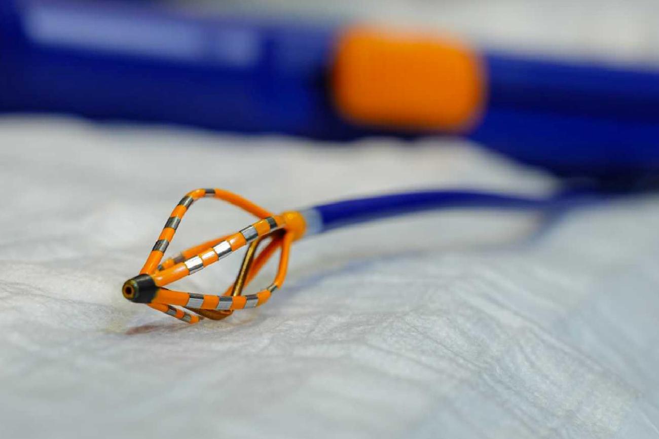 Pulsed Field Ablation (PFA): Ritim Bozukluklarında Yeni Nesil Güvenli Çözüm