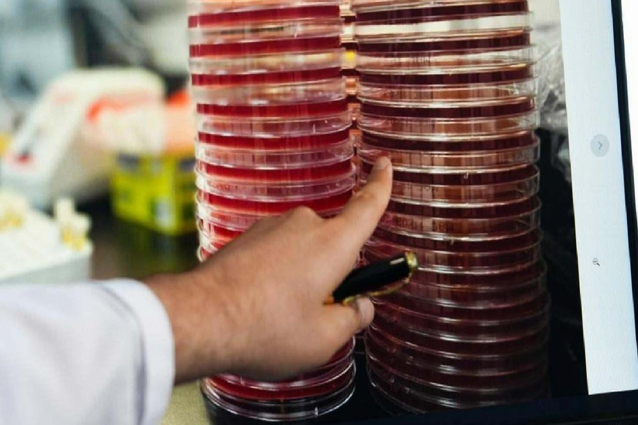 SpaceOmix Projesiyle Göz Mikrobiyomu Uzayda İnceleniyor: Uğur Tunç’un Uluslararası Katkısı