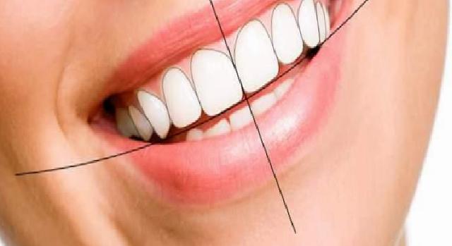 Gülüş Tasarımında Dijital Dönüşüm: Kişiye Özel, Fonksiyonel ve Doğal Sonuçlar