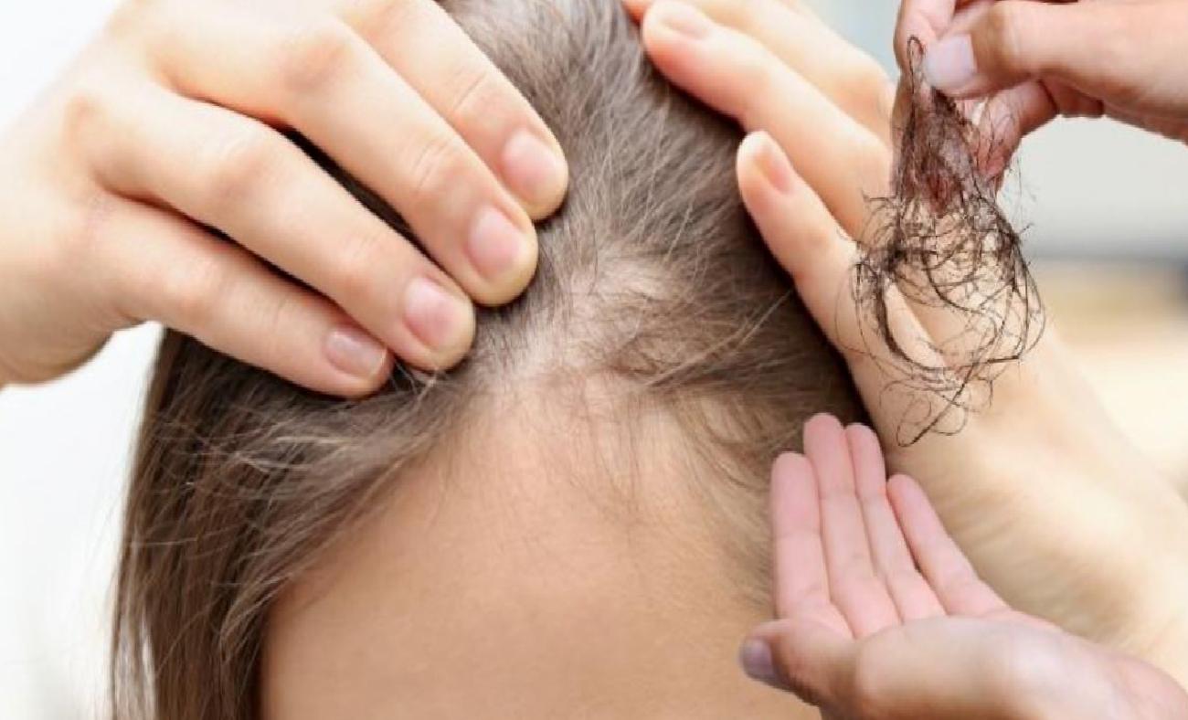 Mevsim Geçişlerinde Saç Dökülmesini Doğal Yöntemlerle Kontrol Etme Rehberi