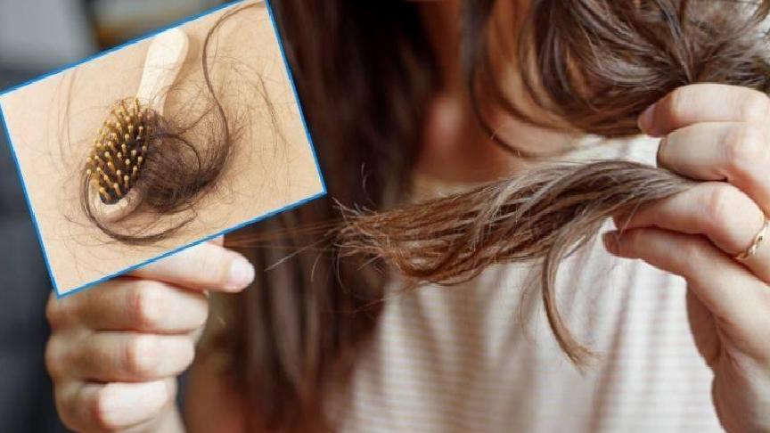 Mevsim Geçişlerinde Saç Dökülmesini Doğal Yöntemlerle Kontrol Etme Rehberi