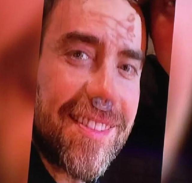 Murat Dalkılıç: Ameliyat İddialarına Yanıt ve Burun Nefesi Hakkında Konuştu