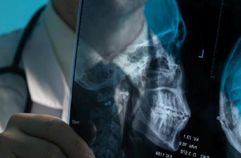 Yaşla Gelen Hafıza Değişimleri: Yanlış Alzheimer Teşhisi Riskine Dair Uzman Uyarısı