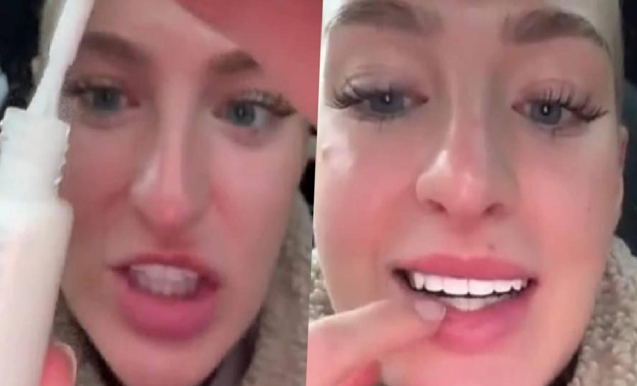 Diş Beyazlatmada Farklı Yaklaşımlar ve Sosyal Medyada Yayılan Video Analizi