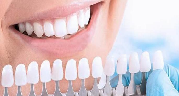 Diş Beyazlatmada Farklı Yaklaşımlar ve Sosyal Medyada Yayılan Video Analizi