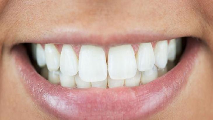 Ağız Sağlığı İçin Karışım: İçerik, Etkileri ve Dikkat Edilmesi Gerekenler