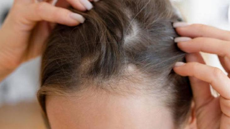 Düzenli Saç Temizliğinin Temel Taşı: Abbey Yung ile Saç Derisi ve Bakım Rutinleri