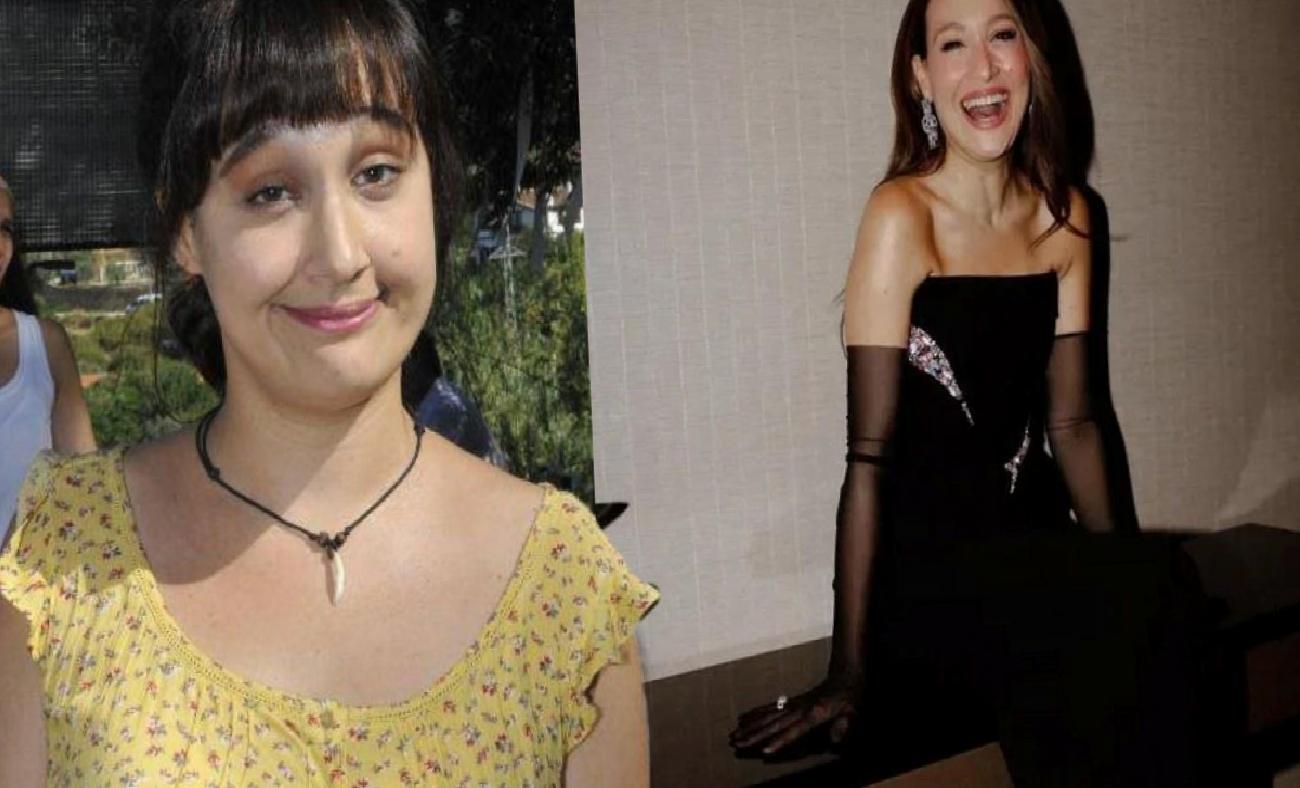 Gupse Özay’ın Ülseratif Kolit Açıklamasıyla Hastalığın Belirtileri ve Tedavisi Gündemde