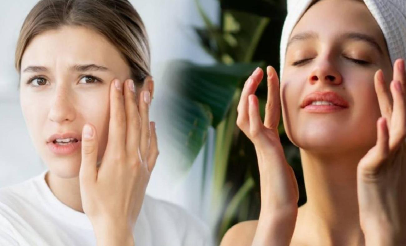 Kışın Cilt Sağlığını Korumak İçin Pratik Bakım Rehberi