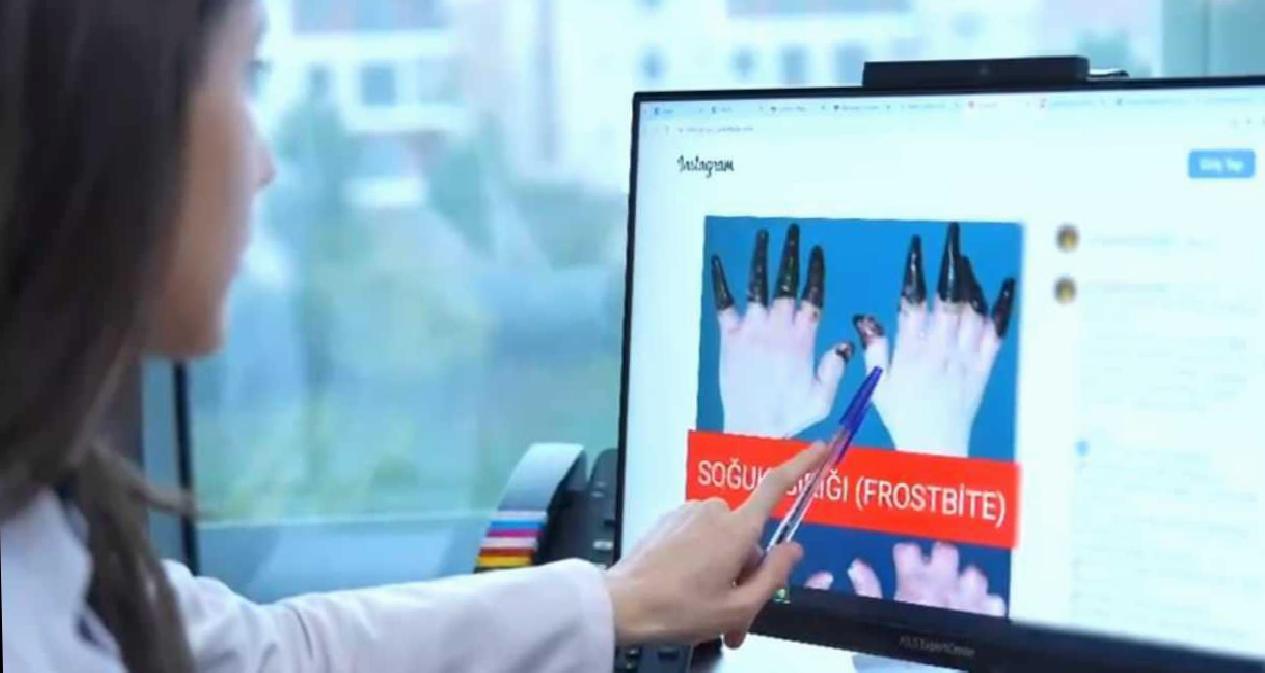 Kışın Soğuk Isırığına Karşı Erken Önlem ve Tedavi Yolu: Uzmanın Uyarıları