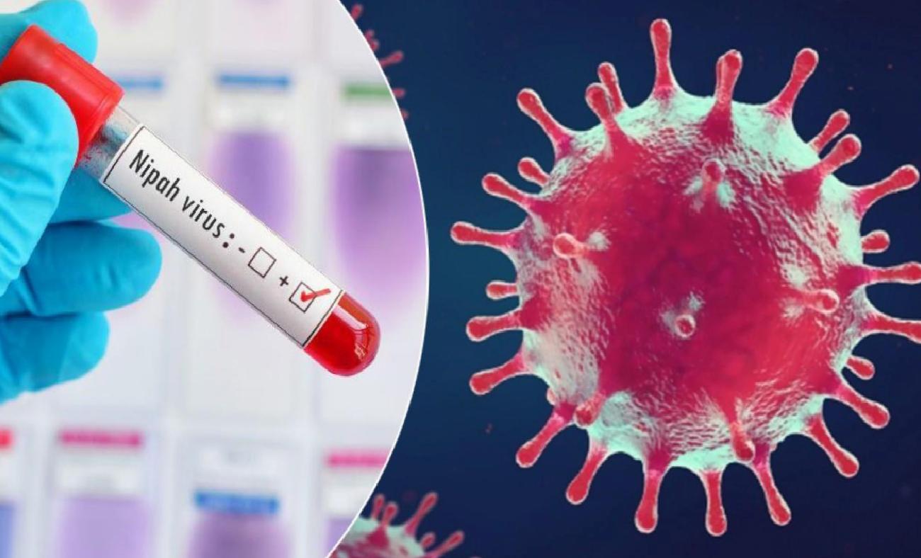 Nipah Virüsü: Belirtiler, Bulaşma Yolları ve Türkiye için Risk Değerlendirmesi