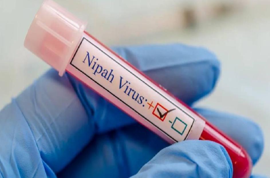 Nipah Virüsü: Belirtiler, Bulaşma Yolları ve Türkiye için Risk Değerlendirmesi