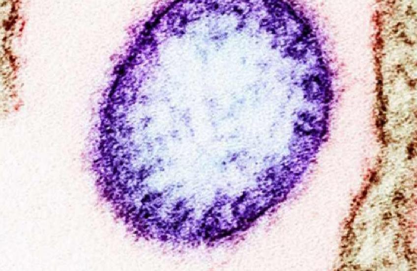 Nipah Virüsü: Belirtiler, Bulaşma Yolları ve Türkiye için Risk Değerlendirmesi