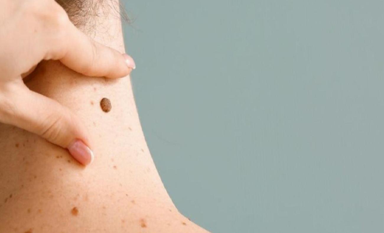 Çocuklukta Benler: Gelişim, Riskler ve Takip