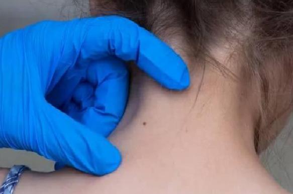 Çocuklukta Benler: Gelişim, Riskler ve Takip