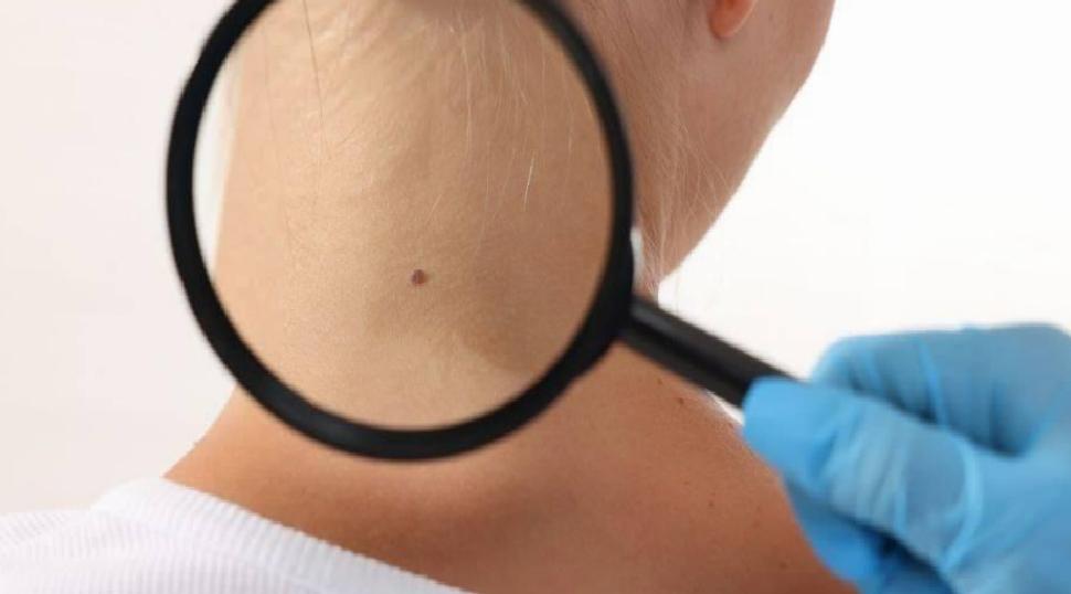 Çocuklukta Benler: Gelişim, Riskler ve Takip