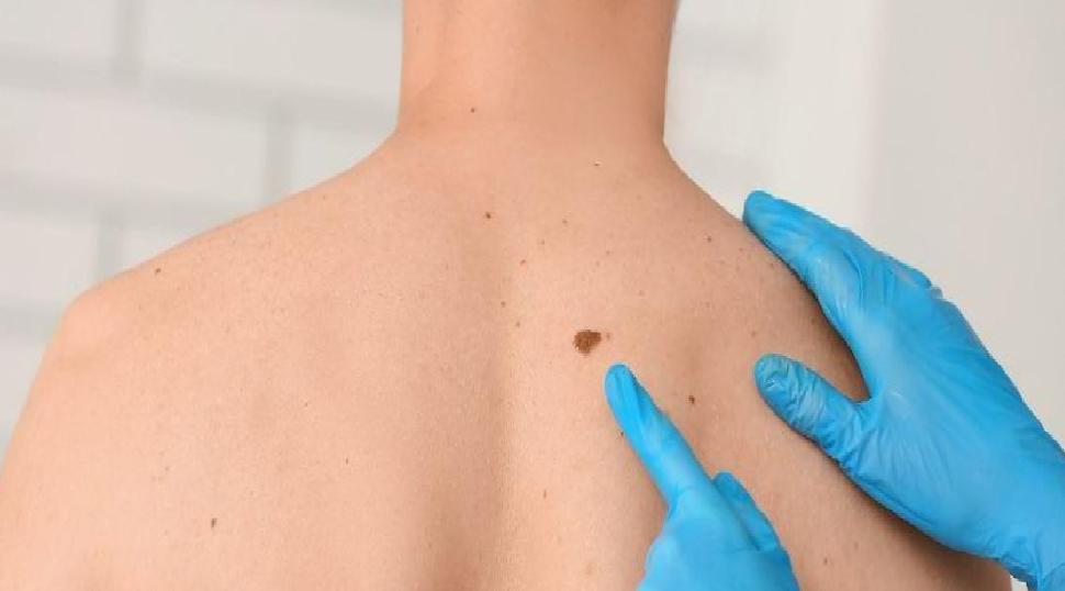 Çocuklukta Benler: Gelişim, Riskler ve Takip