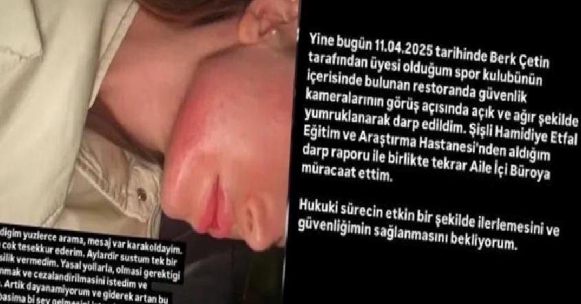 Danla Bilic’i Darp Eden Eski Sevgiliye 5 Ay Hapis, Mahkeme Kararı Açıkladı