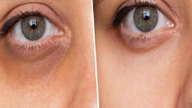 Göz Çevresi İçin Hafif Nemlendirici Karışımlar: Dikkat Edilmesi Gerekenler