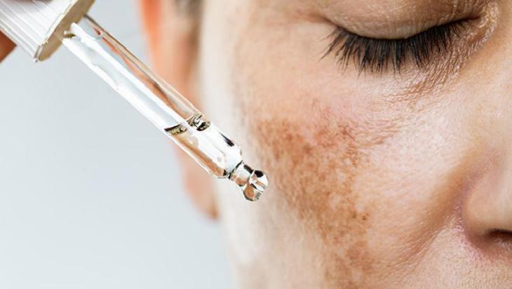 İnce Çizgiler ve Cilt Parlaklığı İçin Mısır Nişastası, Limon ve Süt Karışımı: Faydalar ve Uyarılar