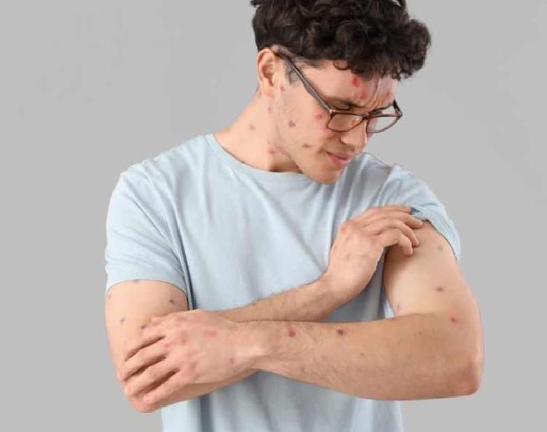 Nadir Hastalıklar: Genetik Kökenli Büyük Bir Sağlık Gerçeği ve Türkiye İçin Etkileri