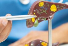 Educational model of a human liver with colorful internal structures being pointed at by tweezers for demonstration.