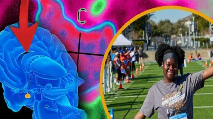 Blue 3D brain model with a red arrow pointing to it, set against a colorful abstract background with a circular photo of people running on a field nearby.